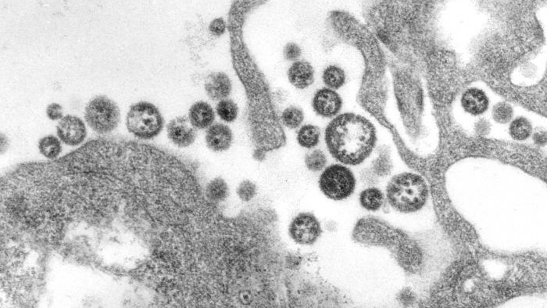 Lassa Virus