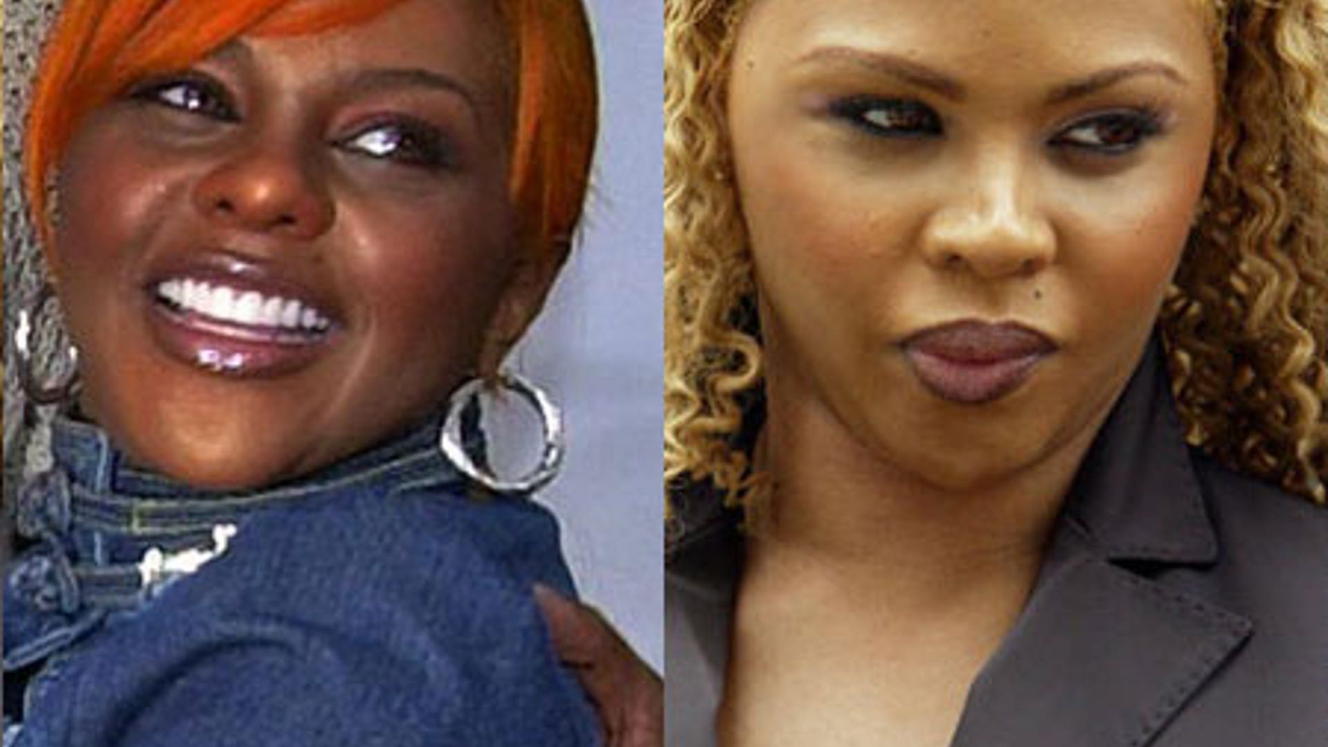 Celebrity Plastic Surgery Disasters Fox News Celebrity Plastic Surgery Disasters Fox News