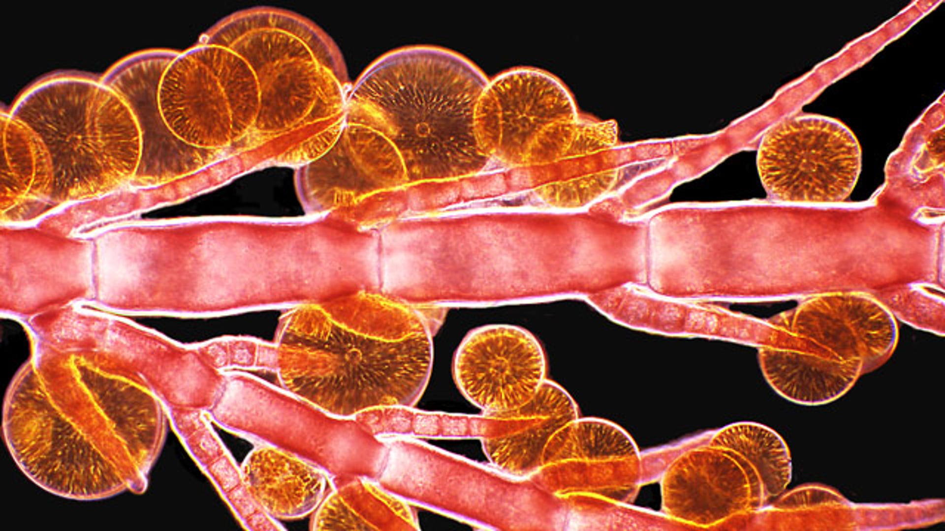 Красные водоросли клетки. Ооцистис водоросль микроскоп. Chlorophyta водоросли под микроскопом. Микроскопические красные водоросли. Водрослипод микроскопом.