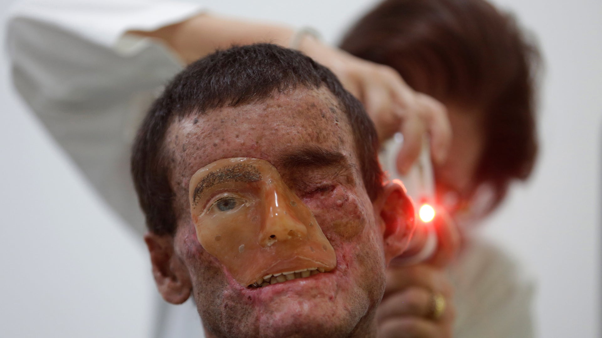 Rare_Disease_Brazil__5_