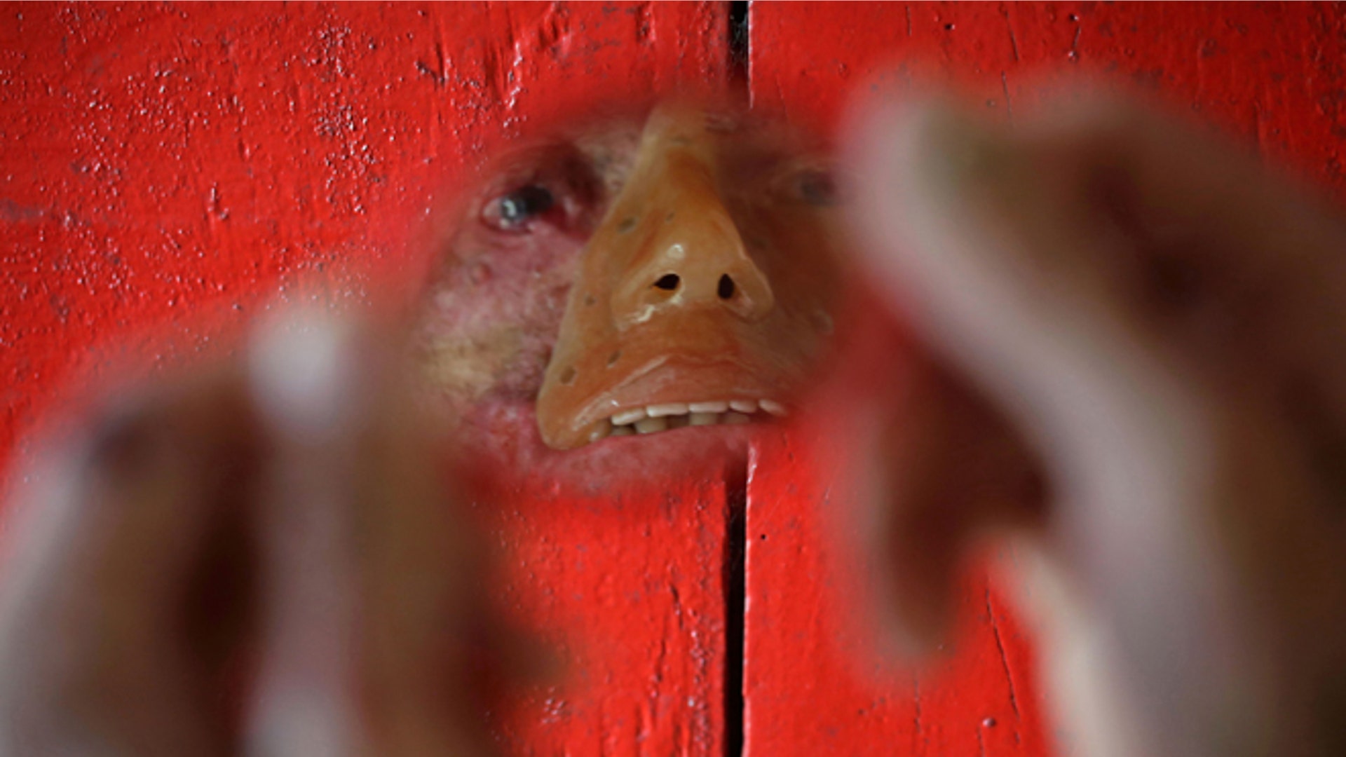 Rare_Disease_Brazil__3_