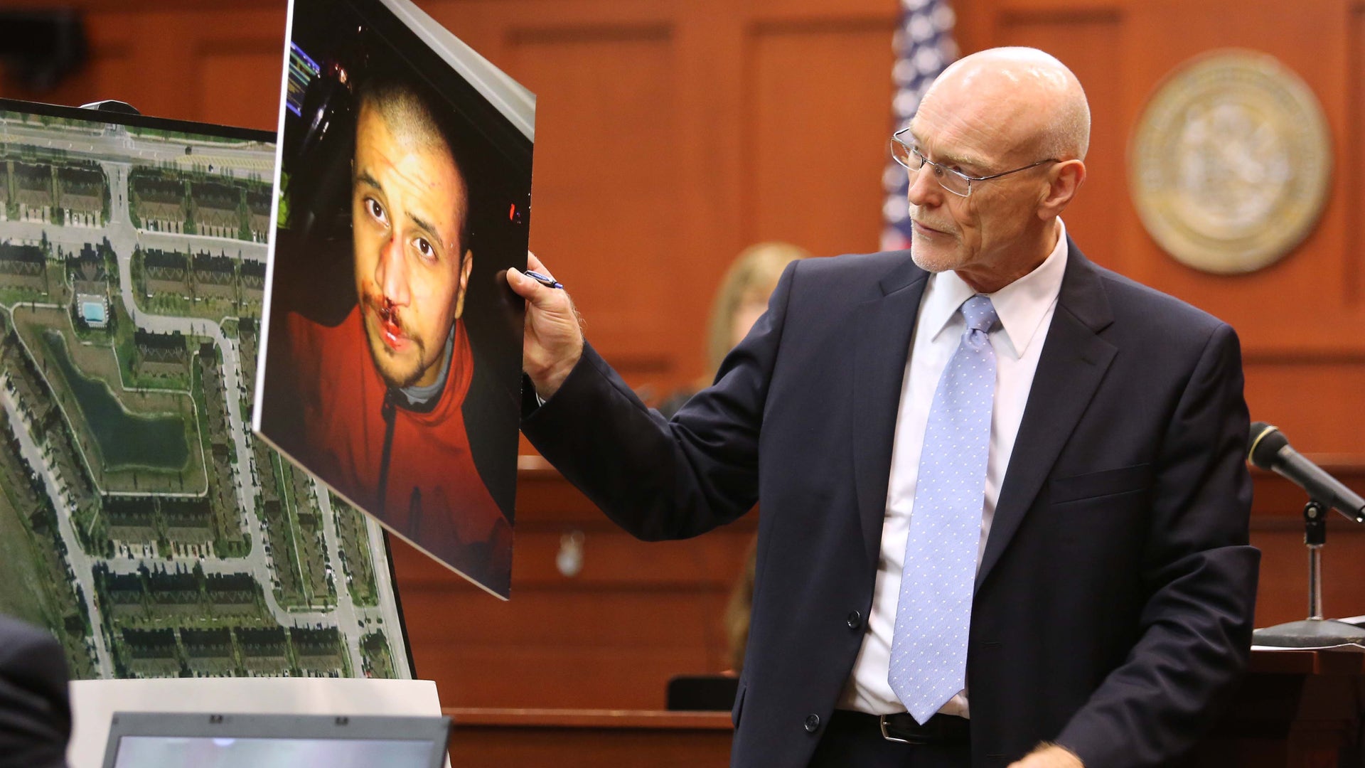 ZIMMERMAN_BLOODY_FACE_PIC