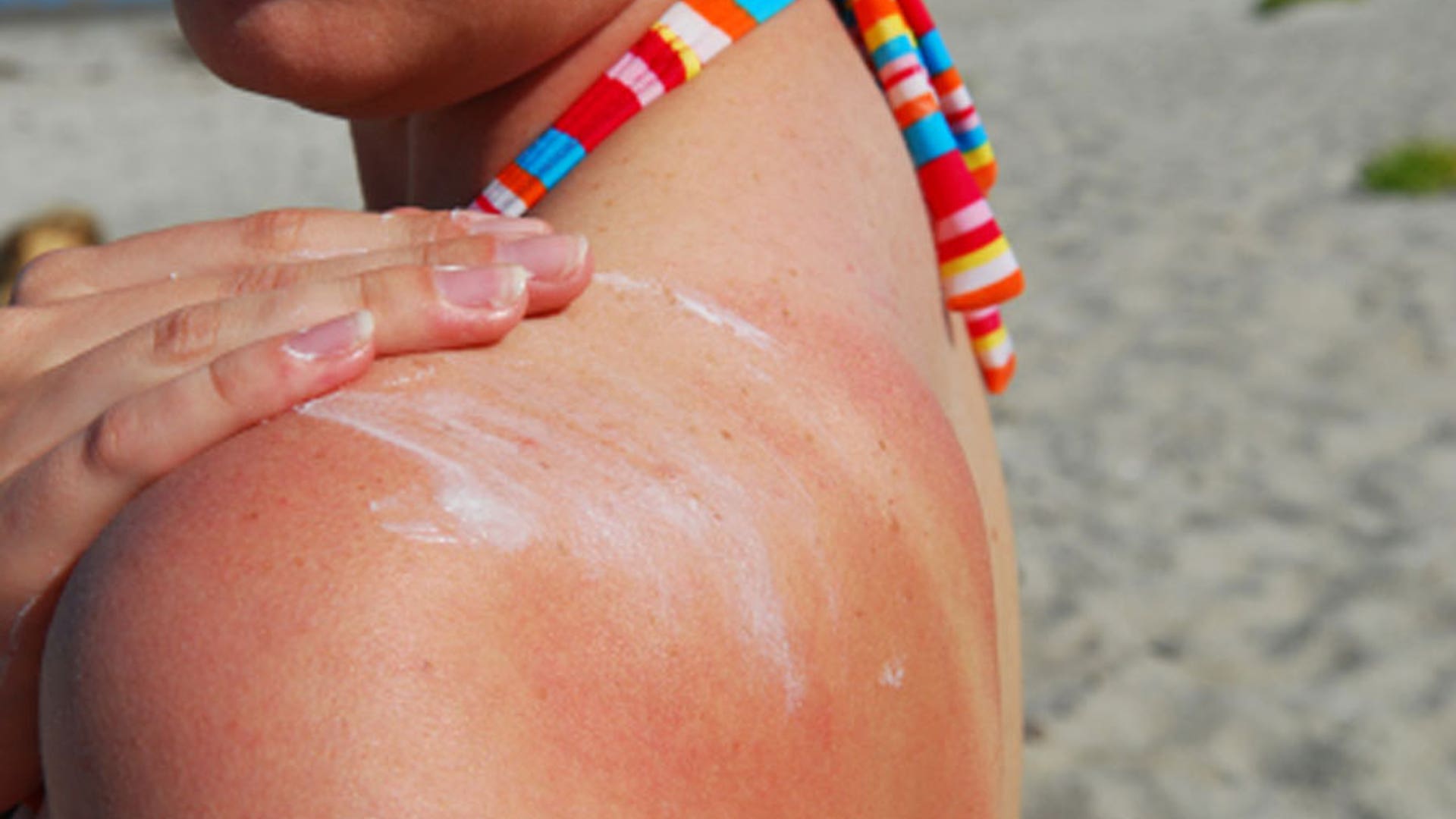 Getting a ‘base tan’ will protect my skin from sun damage