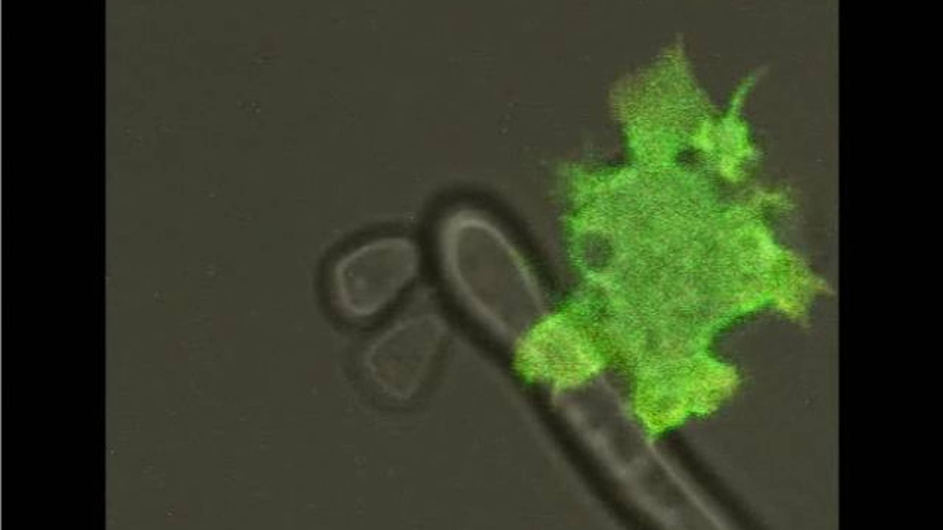 15. Amoeba and Yeast Cell