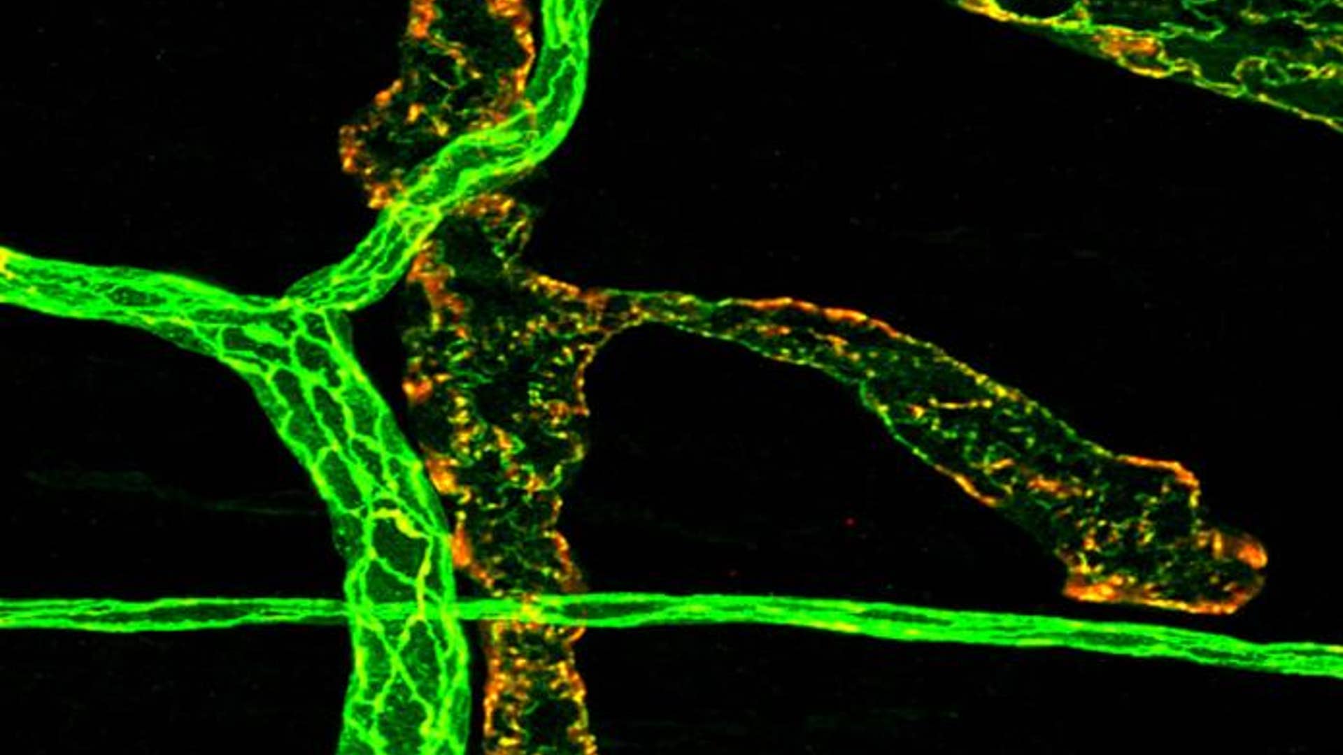 19. Inside a Mouse Colon
