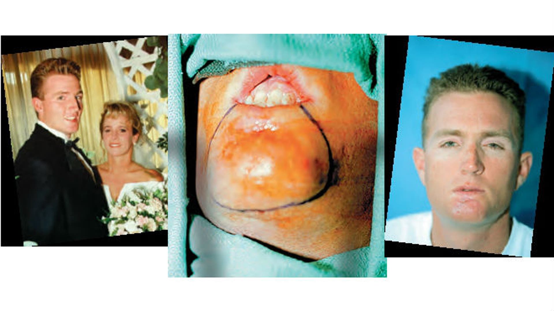 The faces of smokeless tobacco use