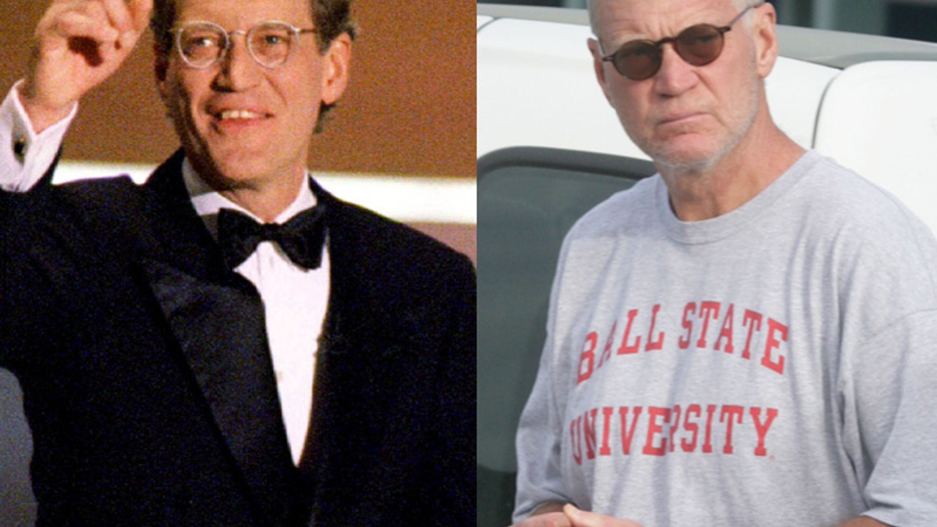 David_Letterman_Hairloss