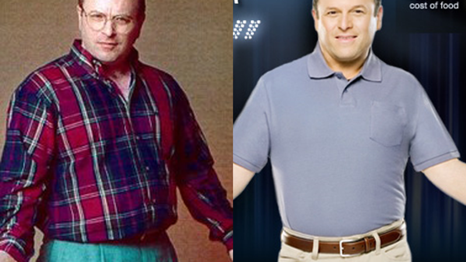 Does Jason Alexander Look Different in 'After' Shot?