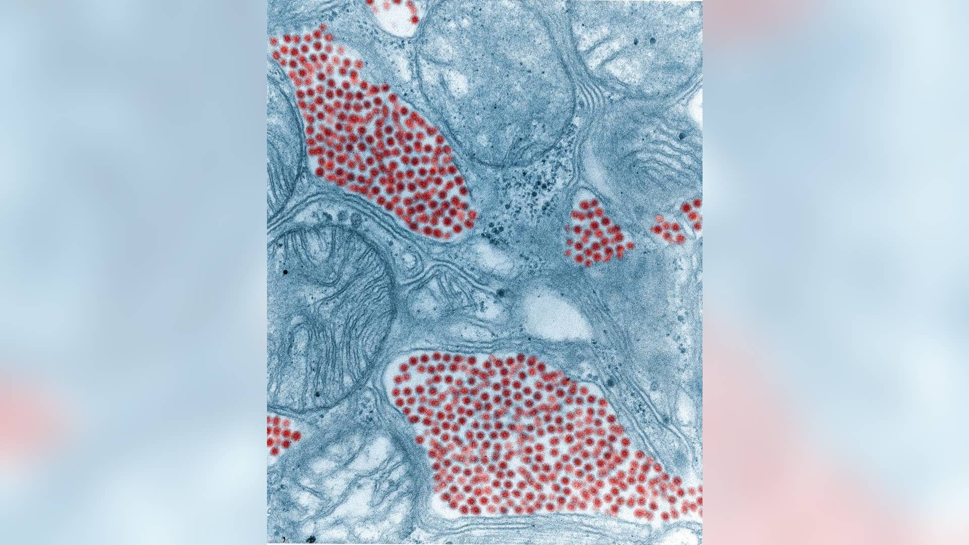 Eastern_Equine_Encephalitis