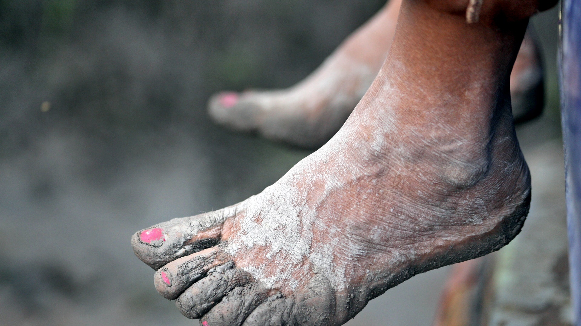 Caked with volcanic ash