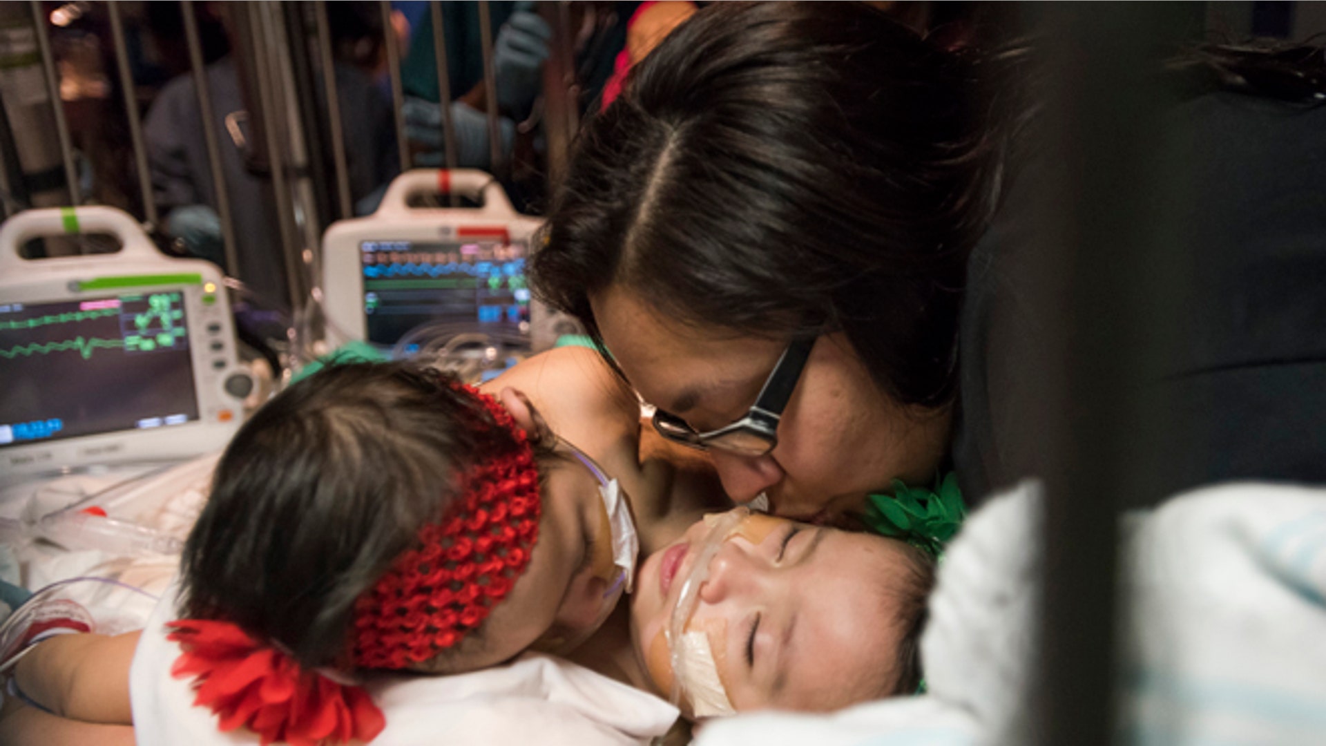 Mata_baby_separation__13_