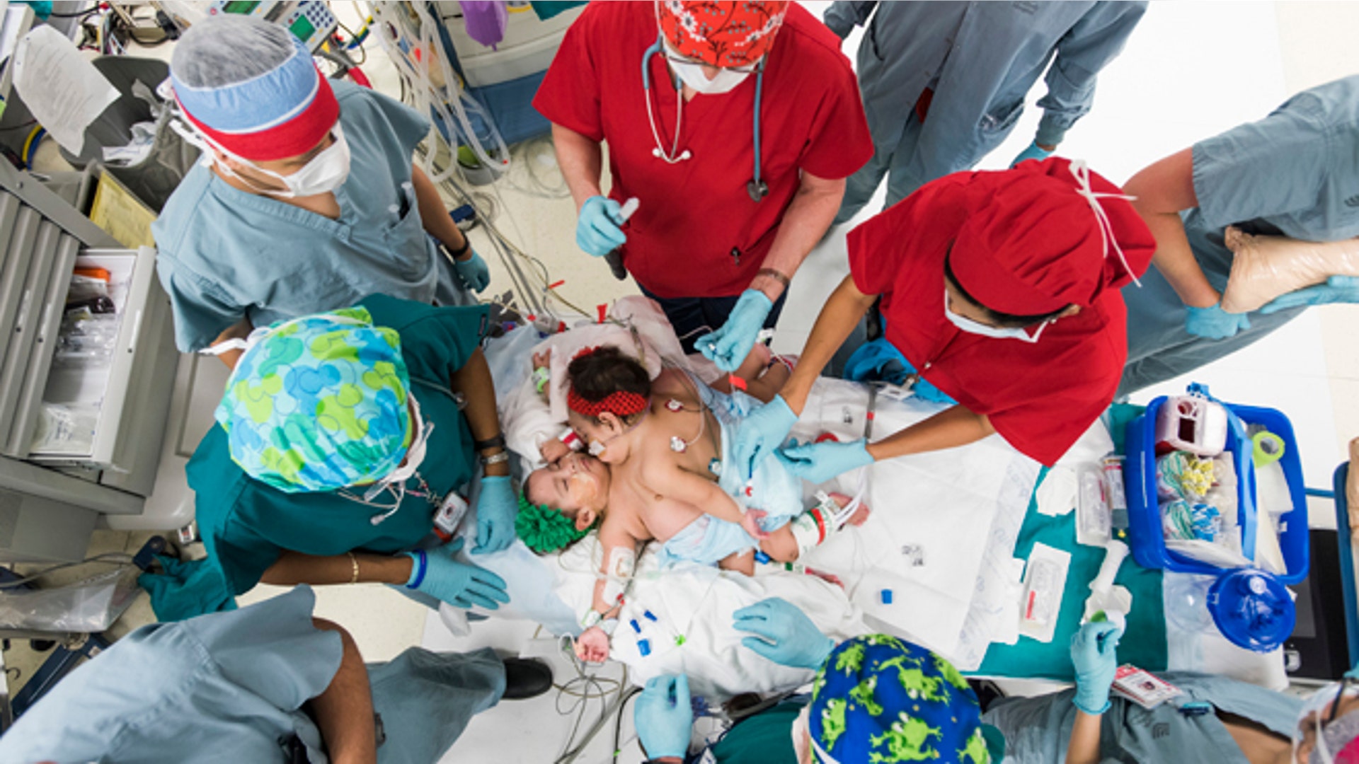 Mata_baby_separation__15_