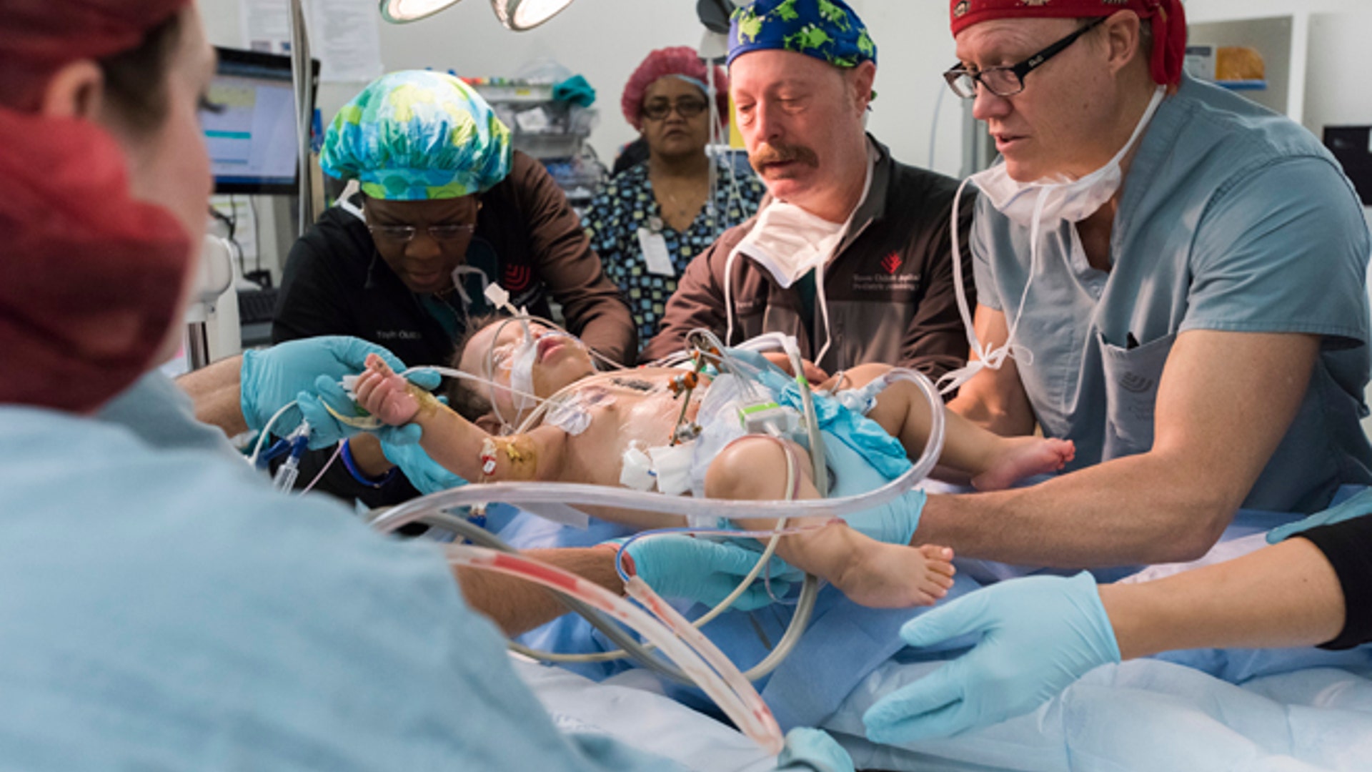 Mata_baby_separation__18_