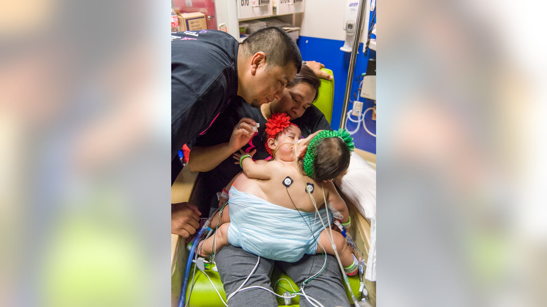 Mata_baby_separation__6_