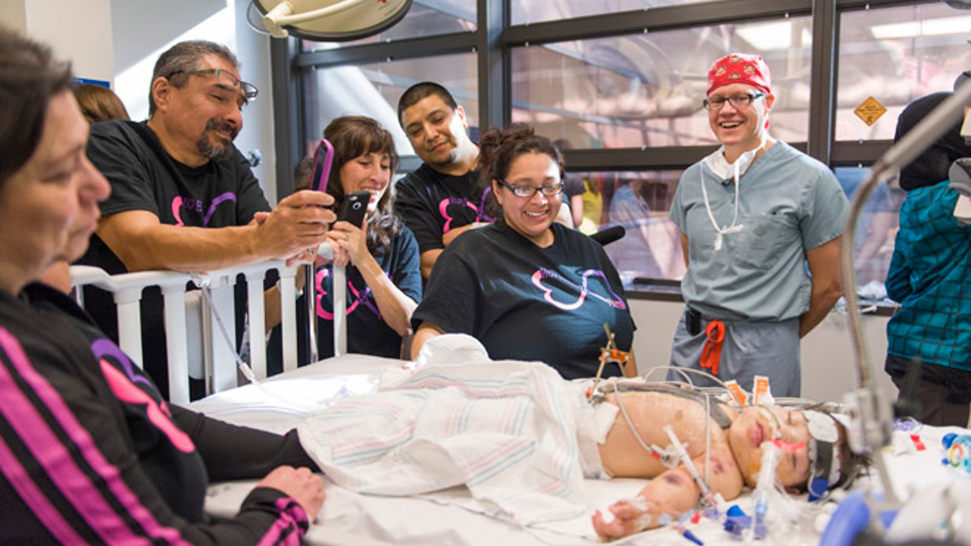 Mata_baby_separation__9_