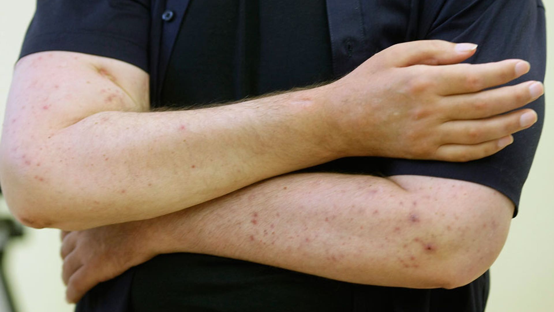 Merk Stands With Arms Crossed