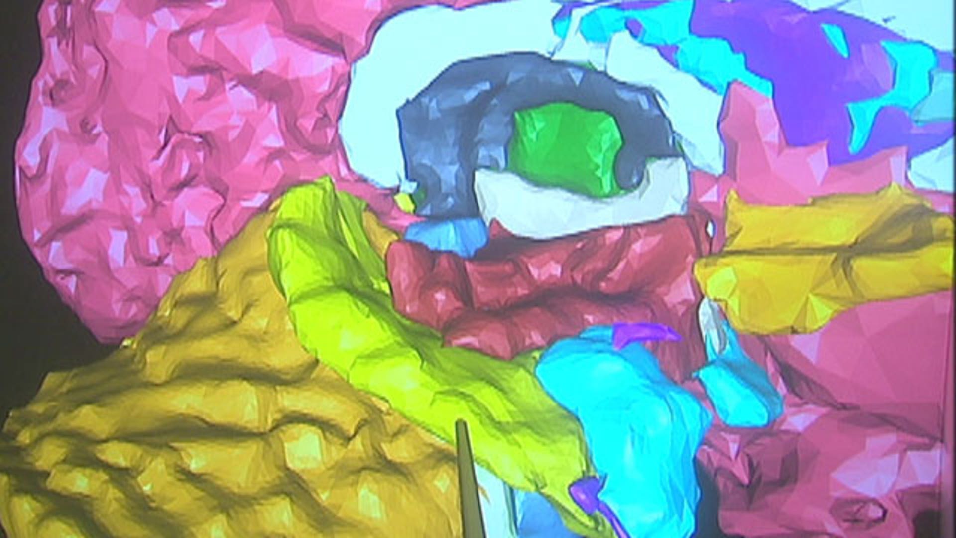 Peeling Away the Mysteries of the Brain