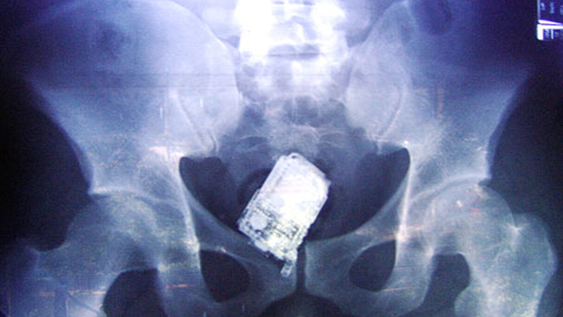 Phone in Stomach