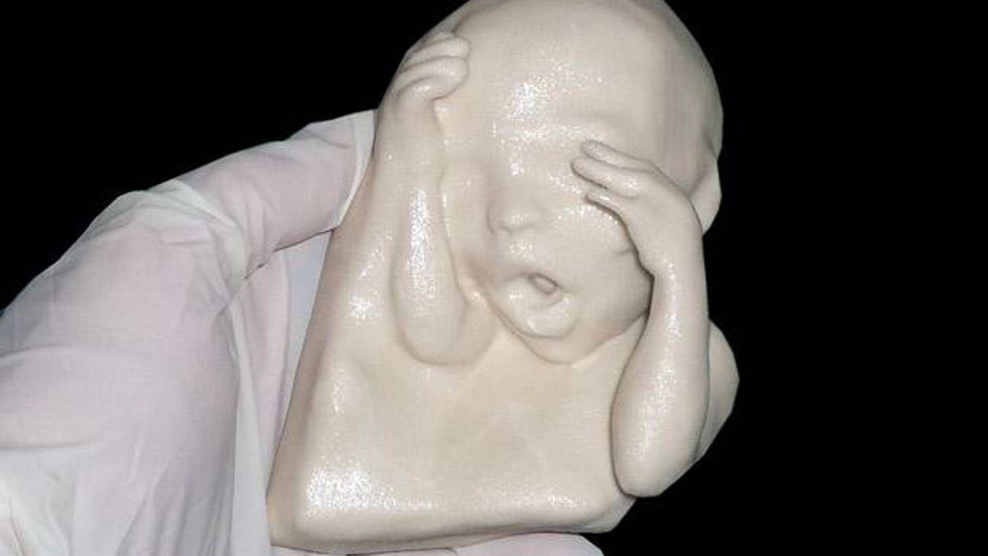 Plastic Representation