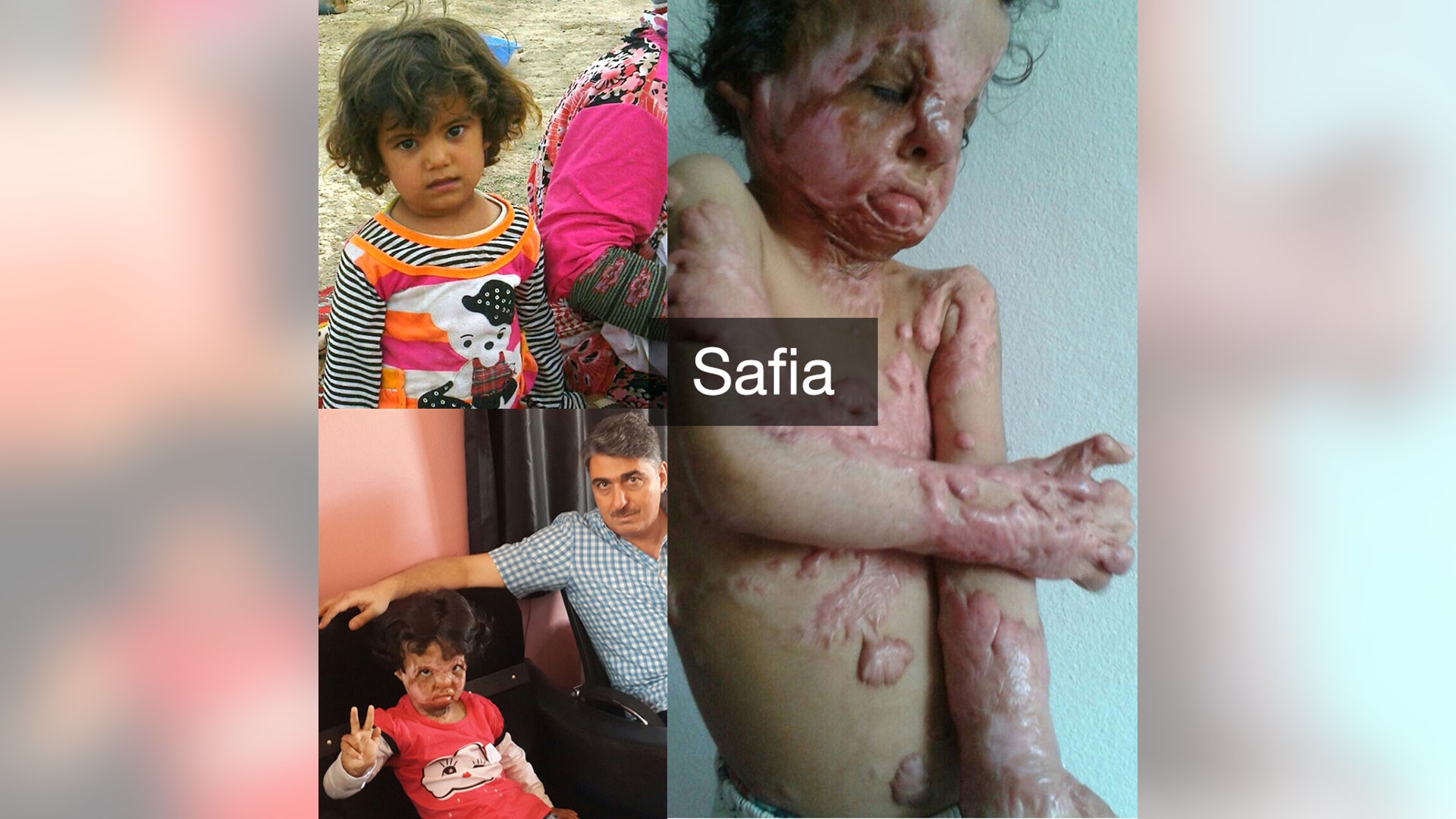 Safia, 2, is currently undergoing treatment.