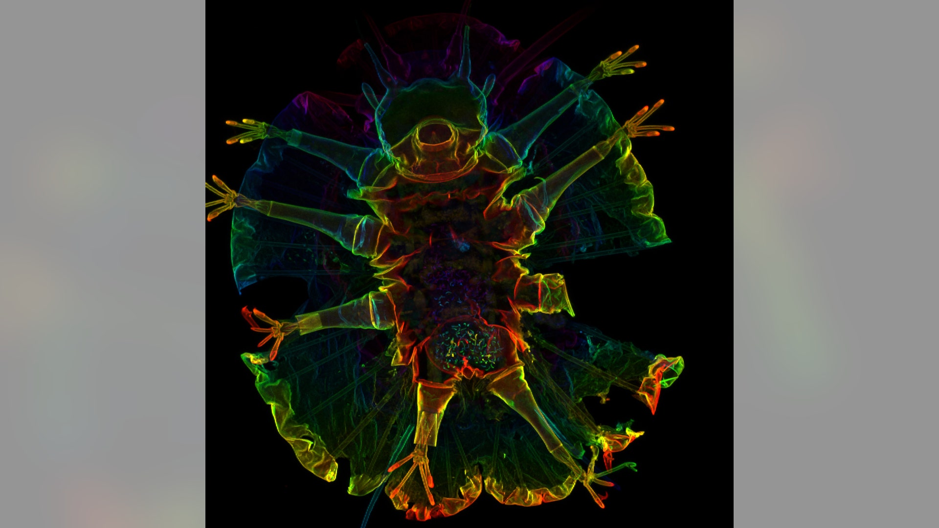 Schmidt_Rhaesa_Entry_23994_Actinarctus_doryphorus