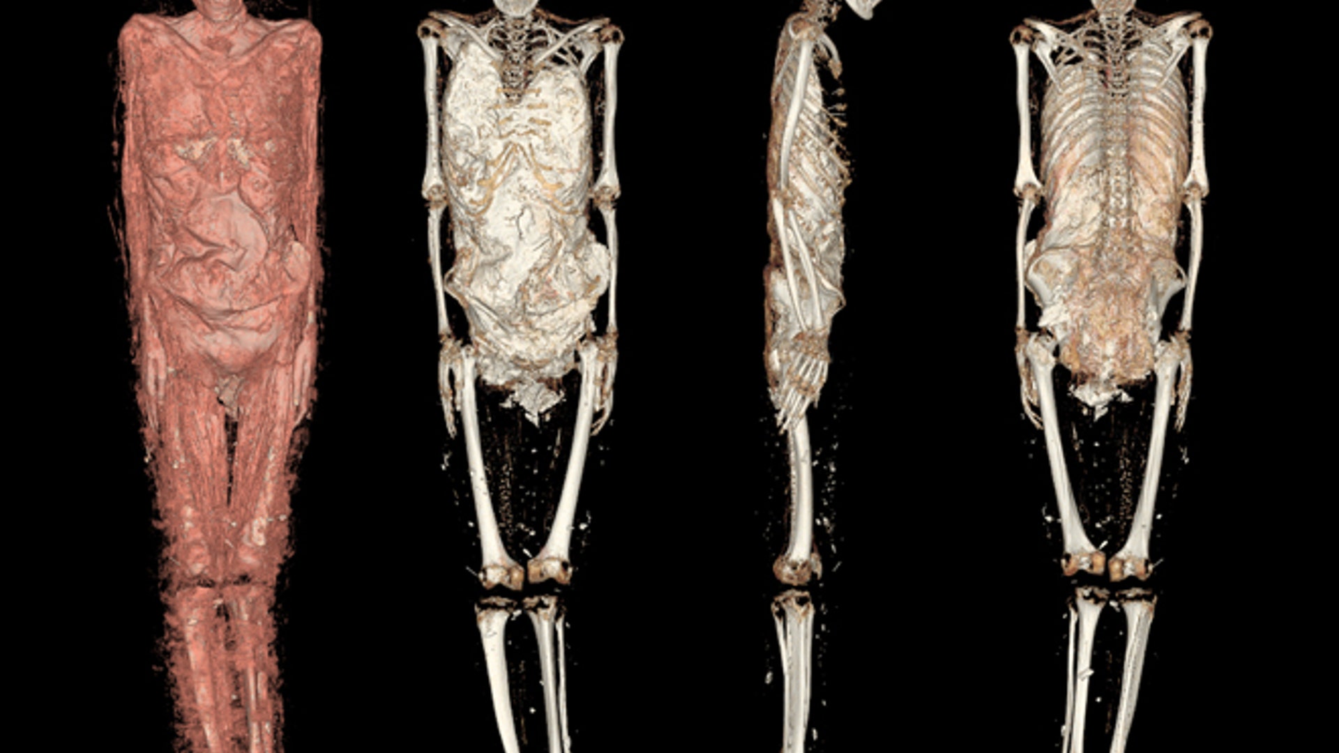 Spanish_mummies__18_