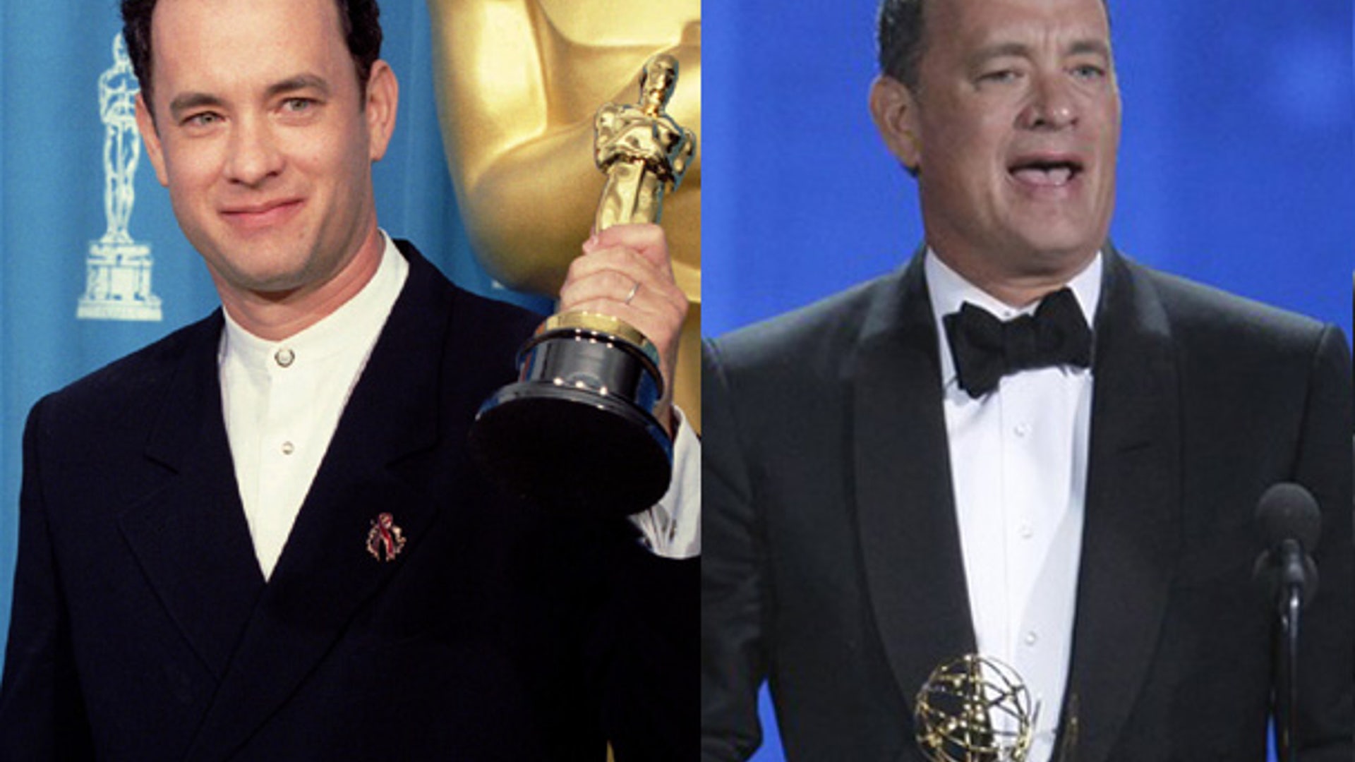 Tom_Hanks_Hairloss