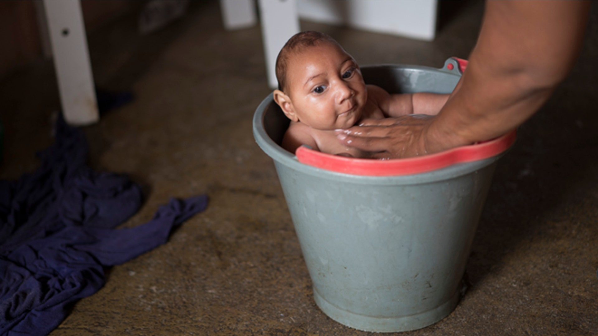 Zika_virus_defects_Latino