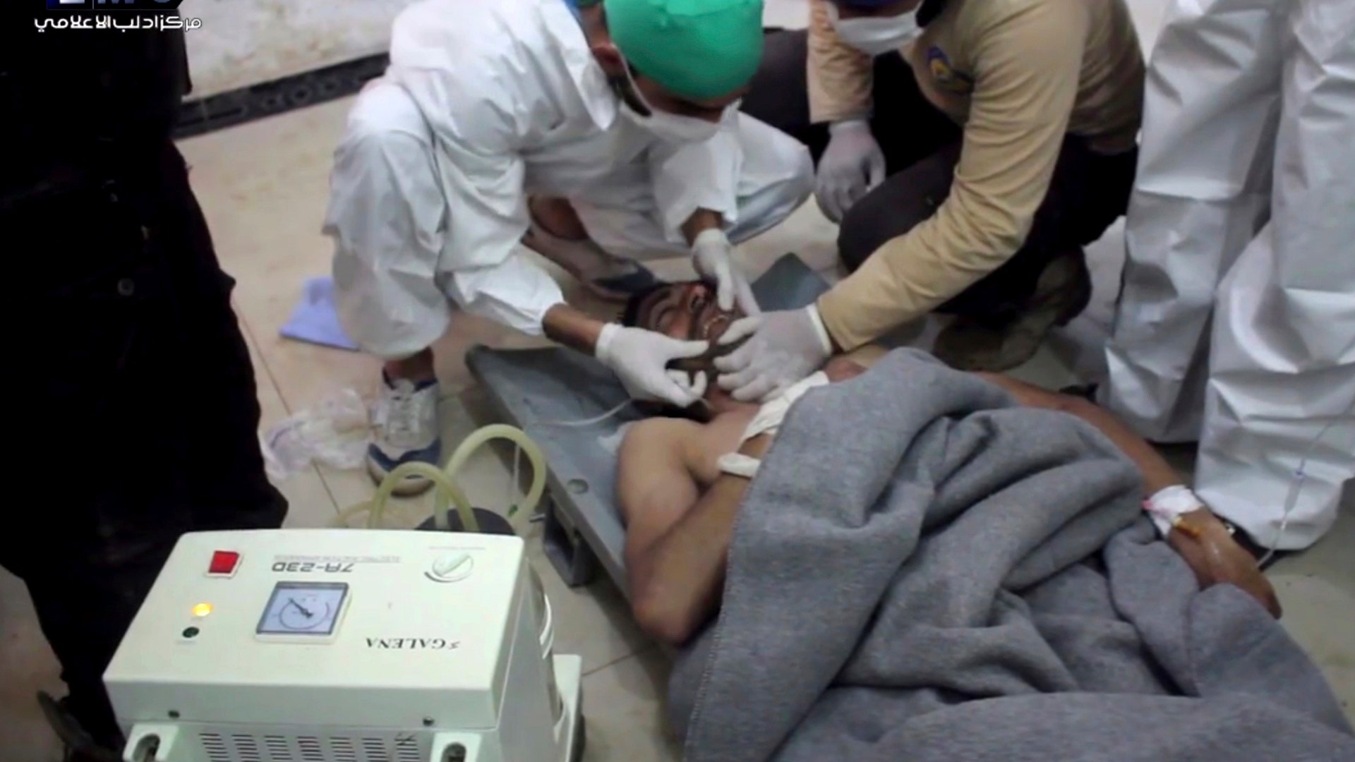 A victim of a suspected chemical attack as he receives treatment at a makeshift hospital.