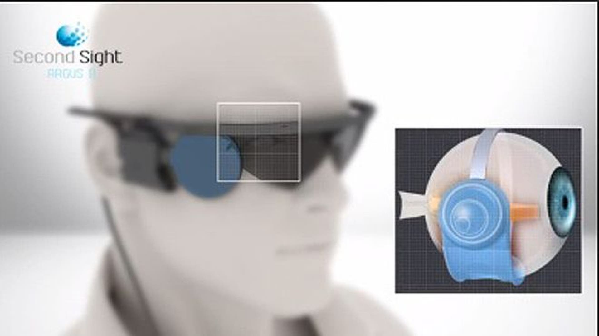 World’s only bionic eyes