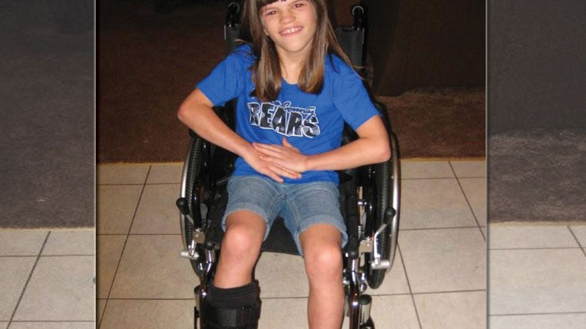 Ashlyn with a broken leg