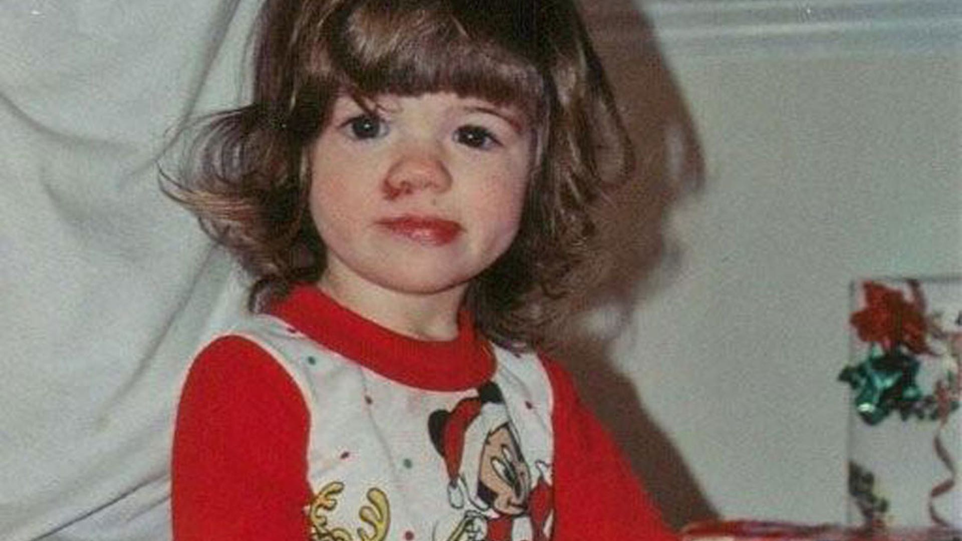 Ashlyn shows effects of pain insensitivity