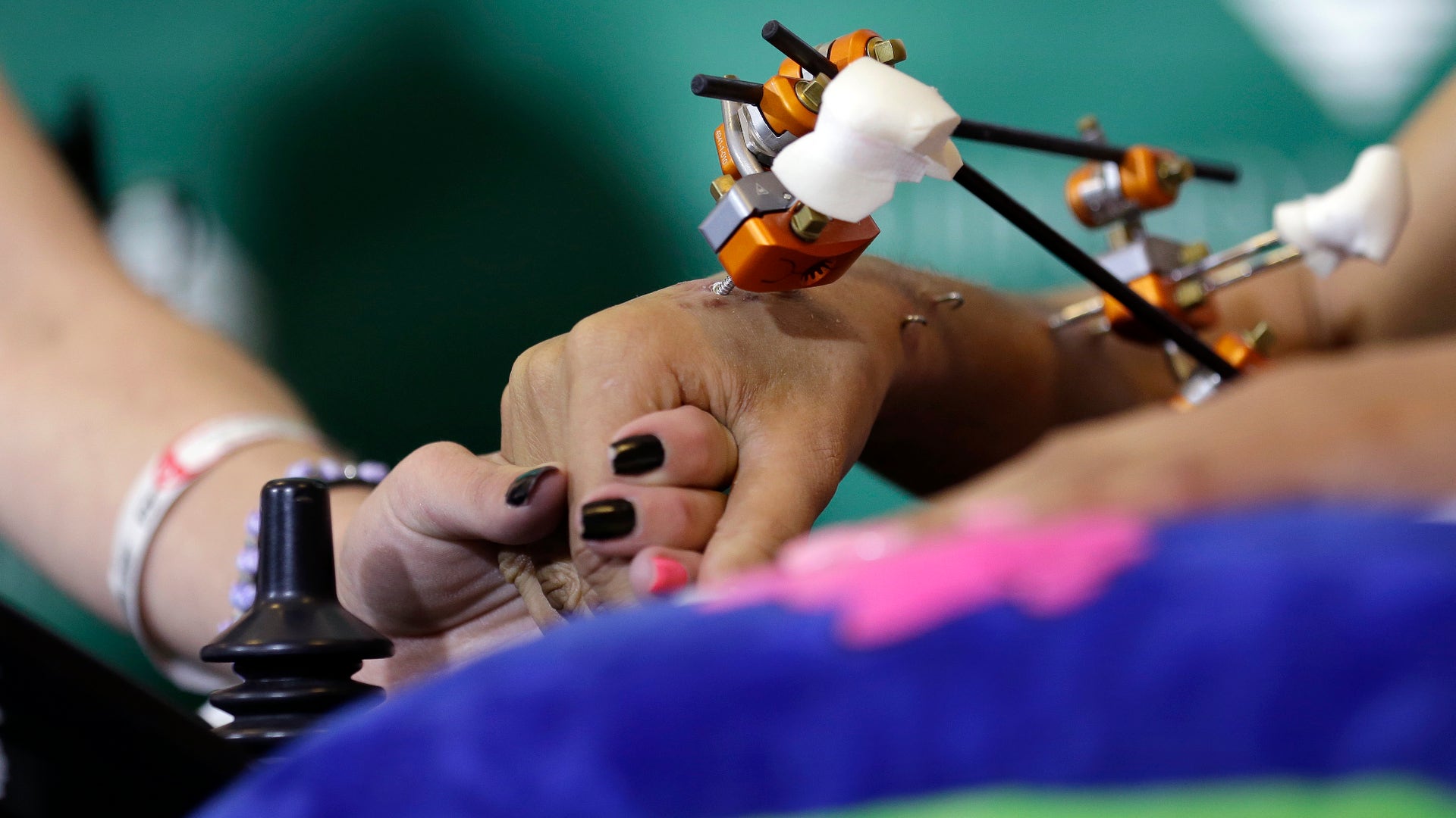 Circus_Accident_Vros__3_