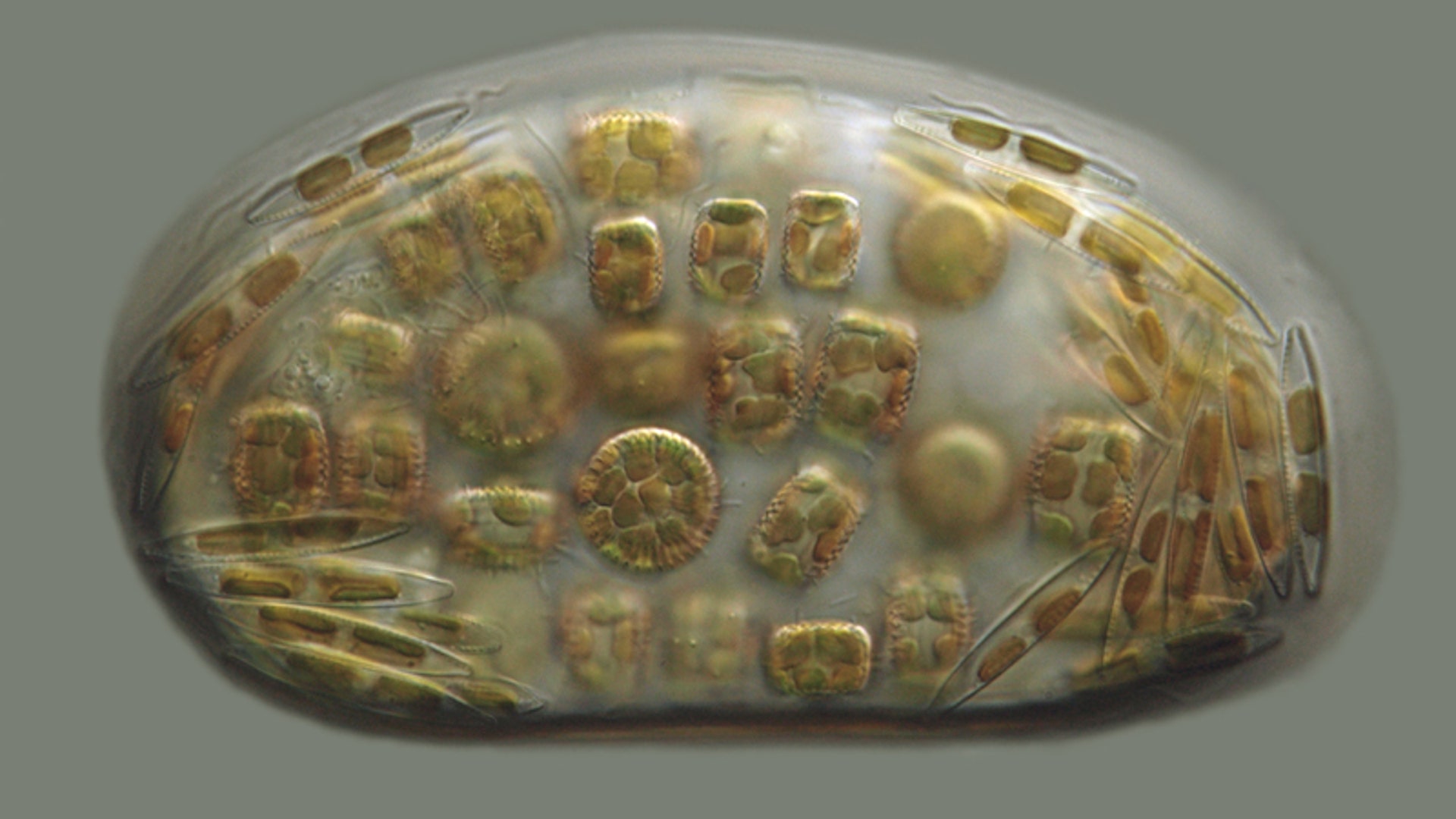 freshwater_diatom_cells