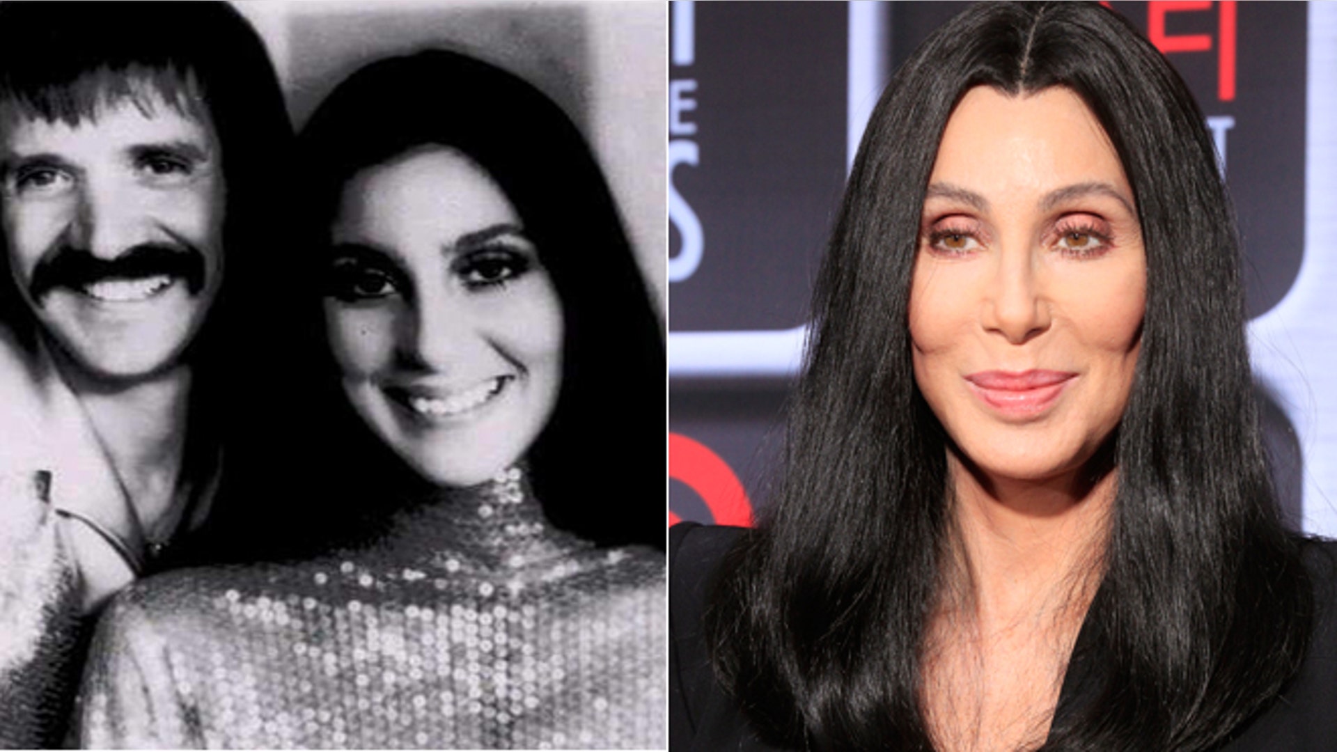Celebrity plastic surgery disasters | Fox News