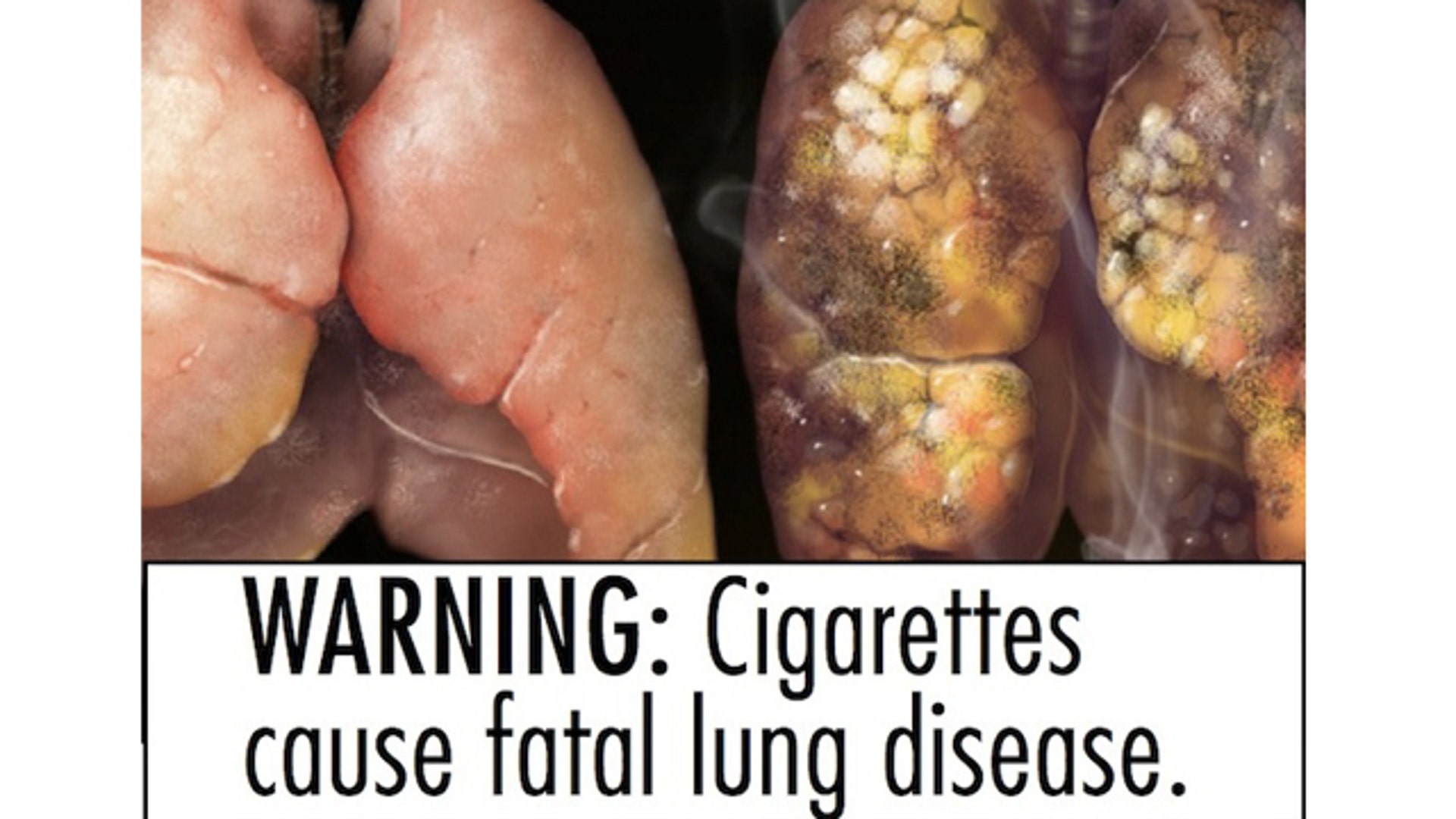 Smokinglabel_FDA_lung