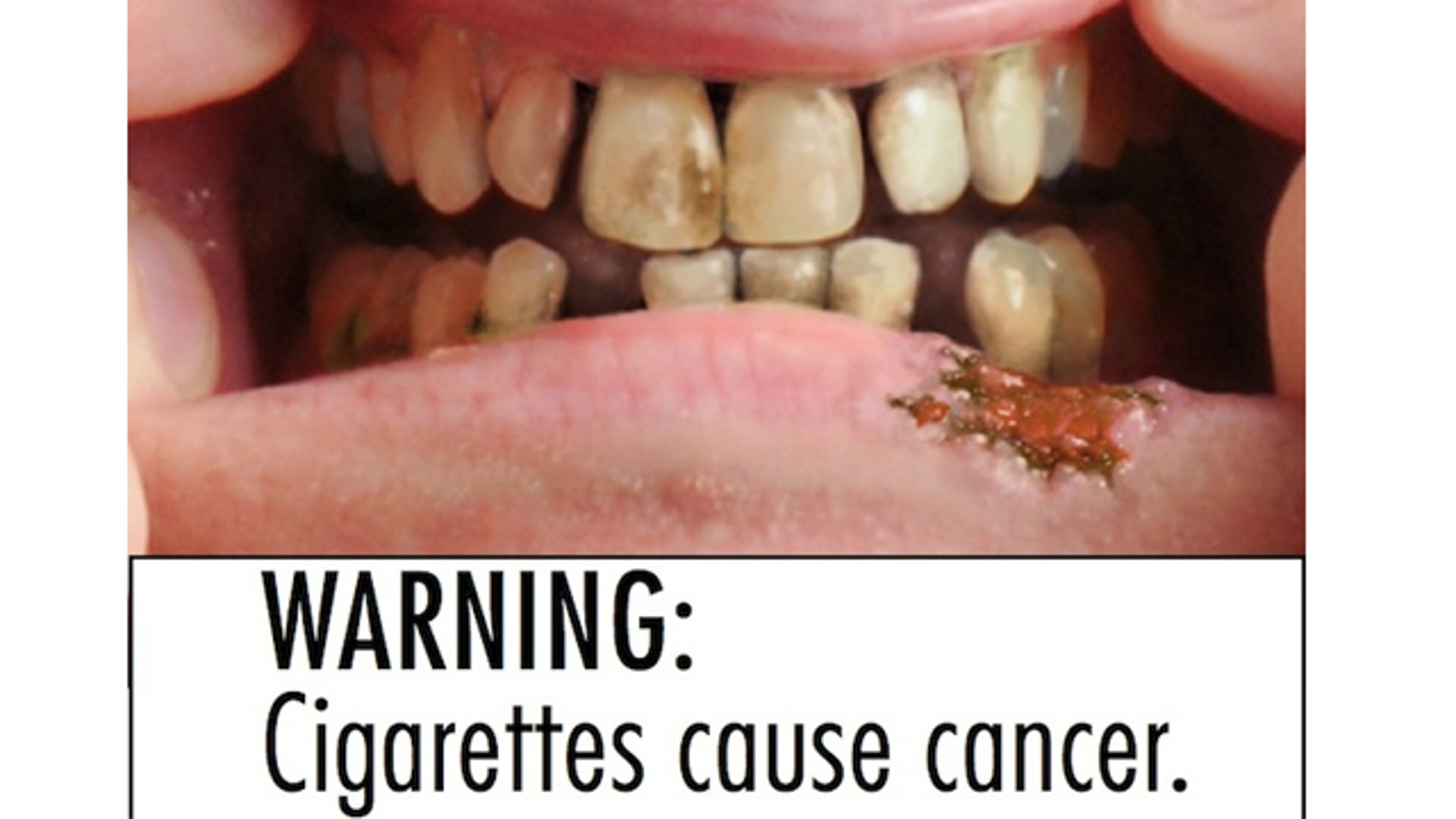 Smokinglabel_FDA_teeth