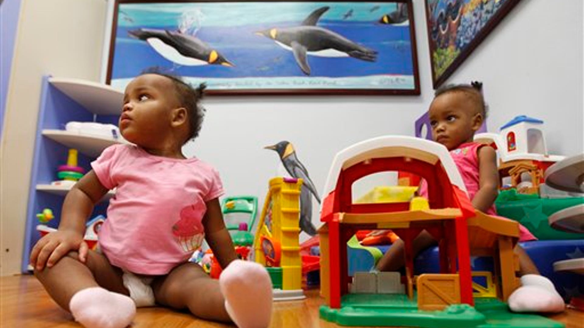 dominican_conjoined_6