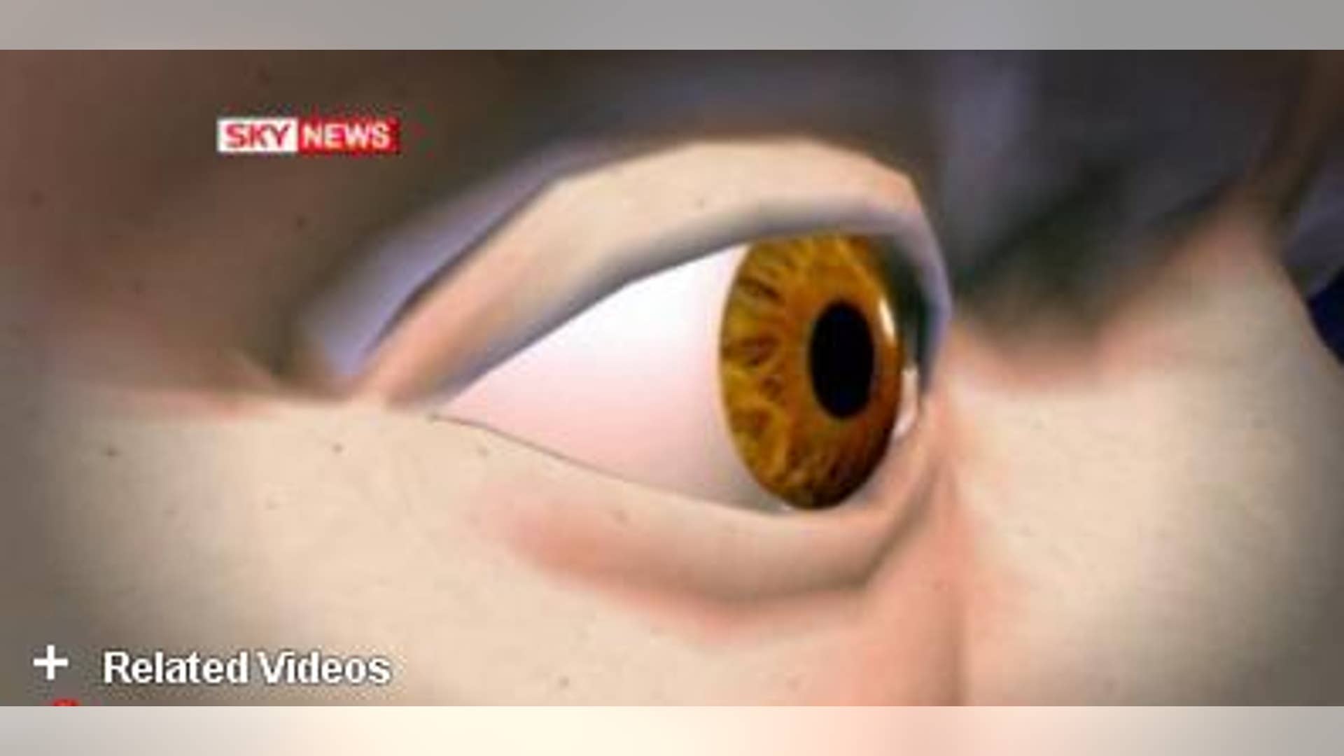 High-Definition Eyeballs