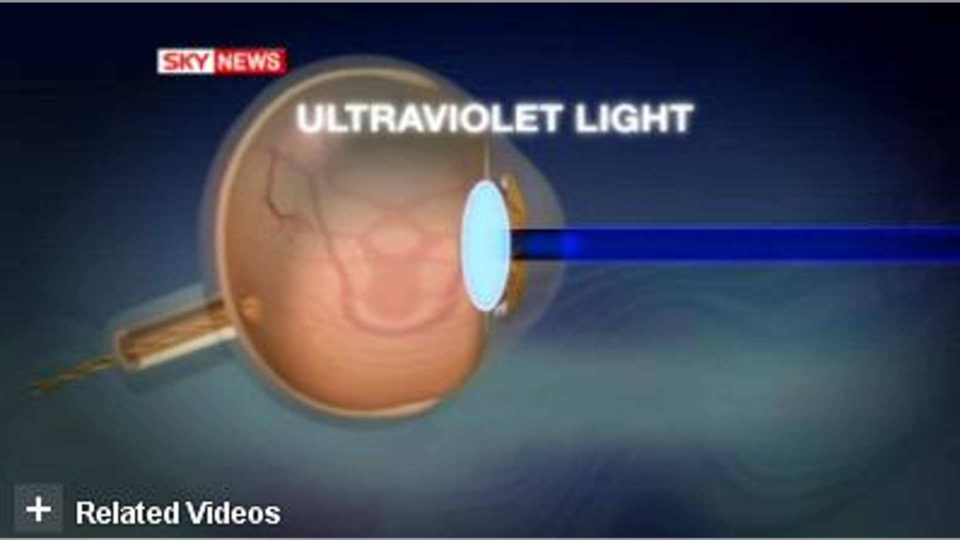 High-Definition Eyeballs