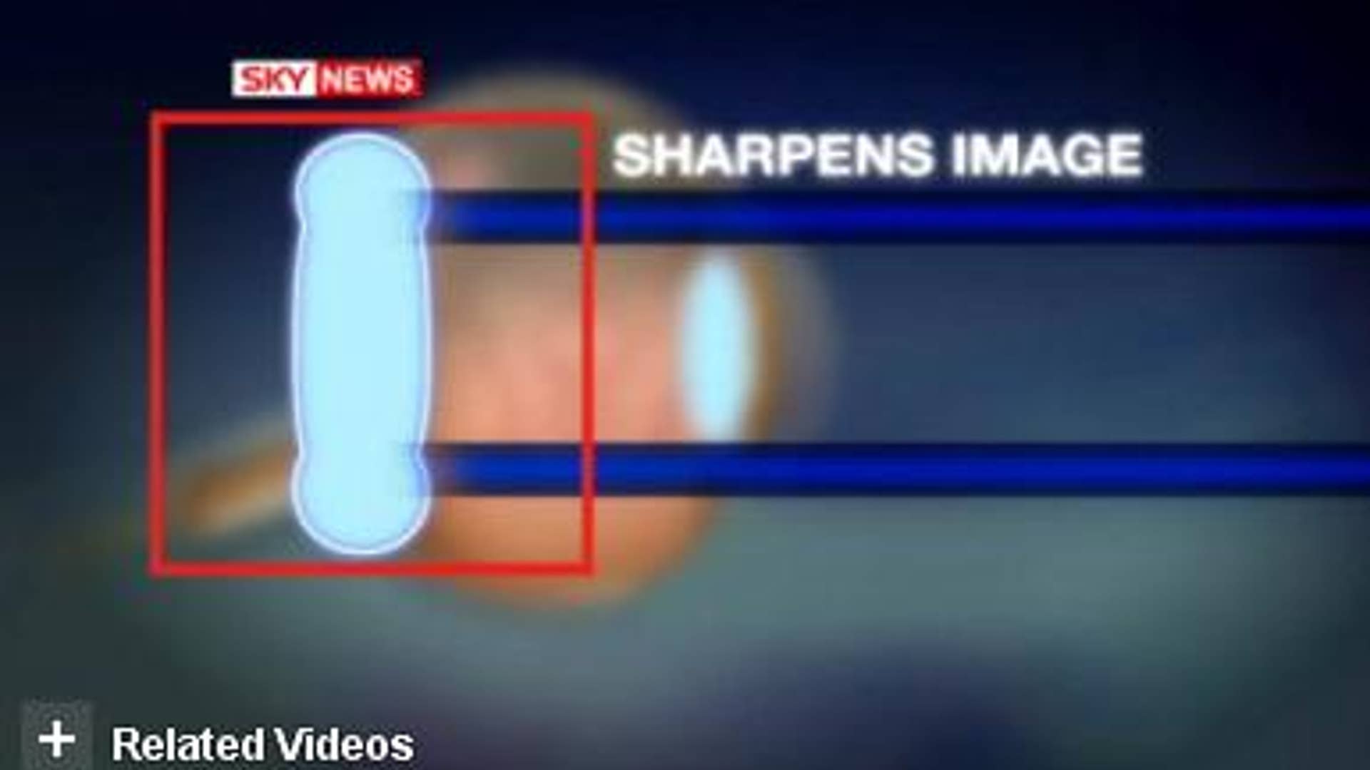 High-Definition Eyeballs