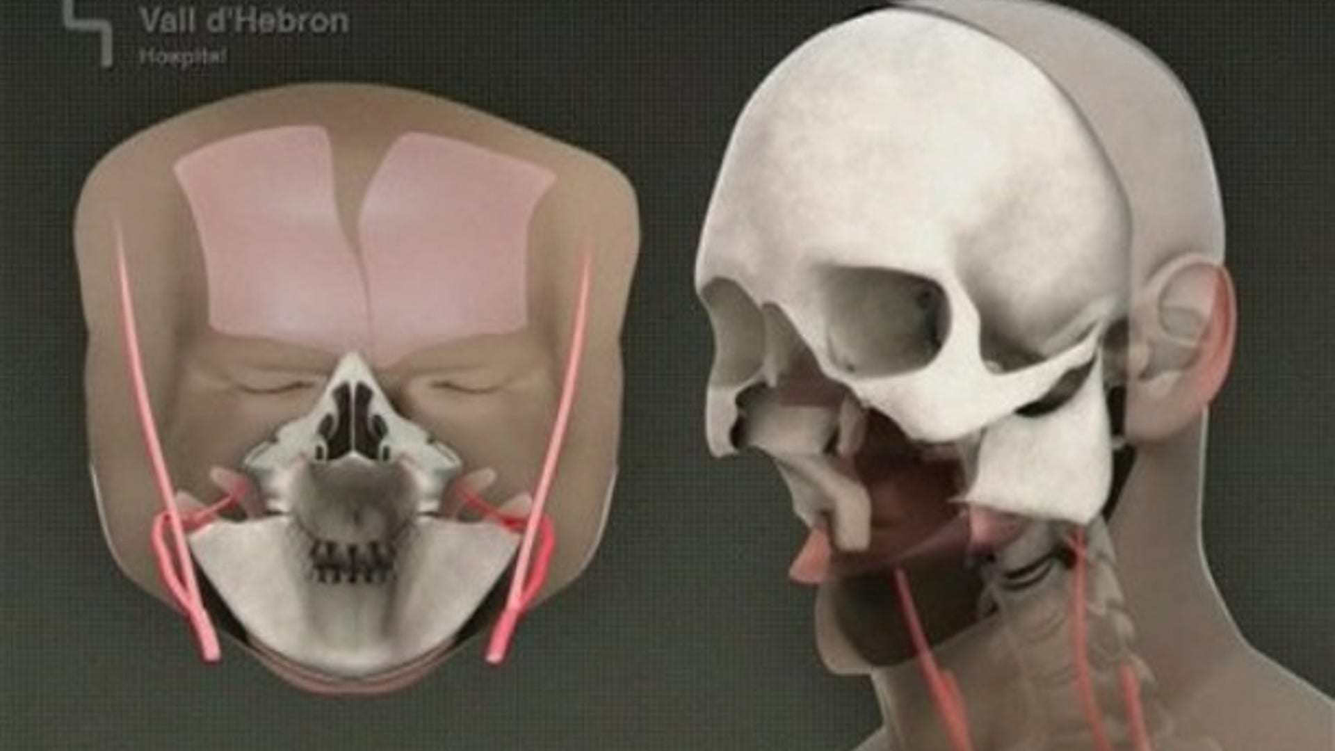 Computer-Generated Image 