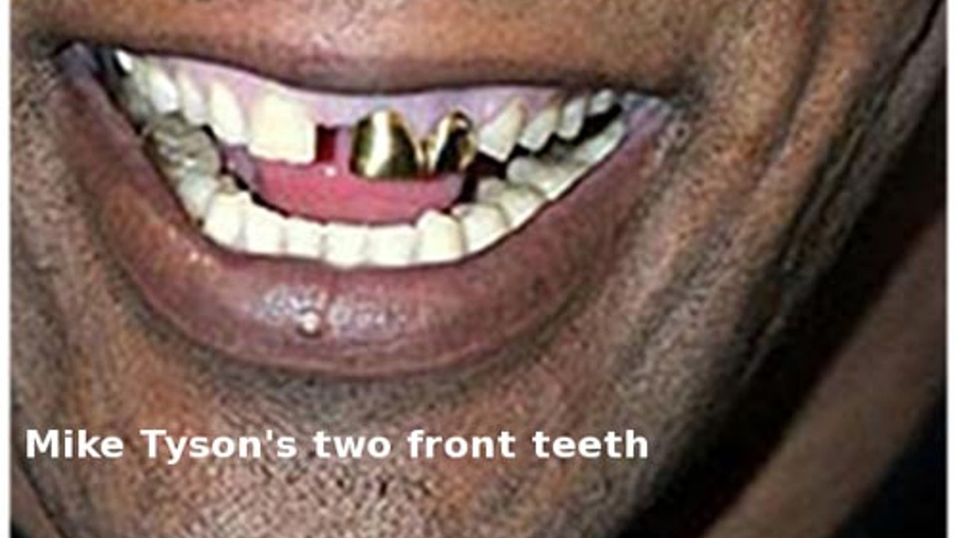 On the Auction Block