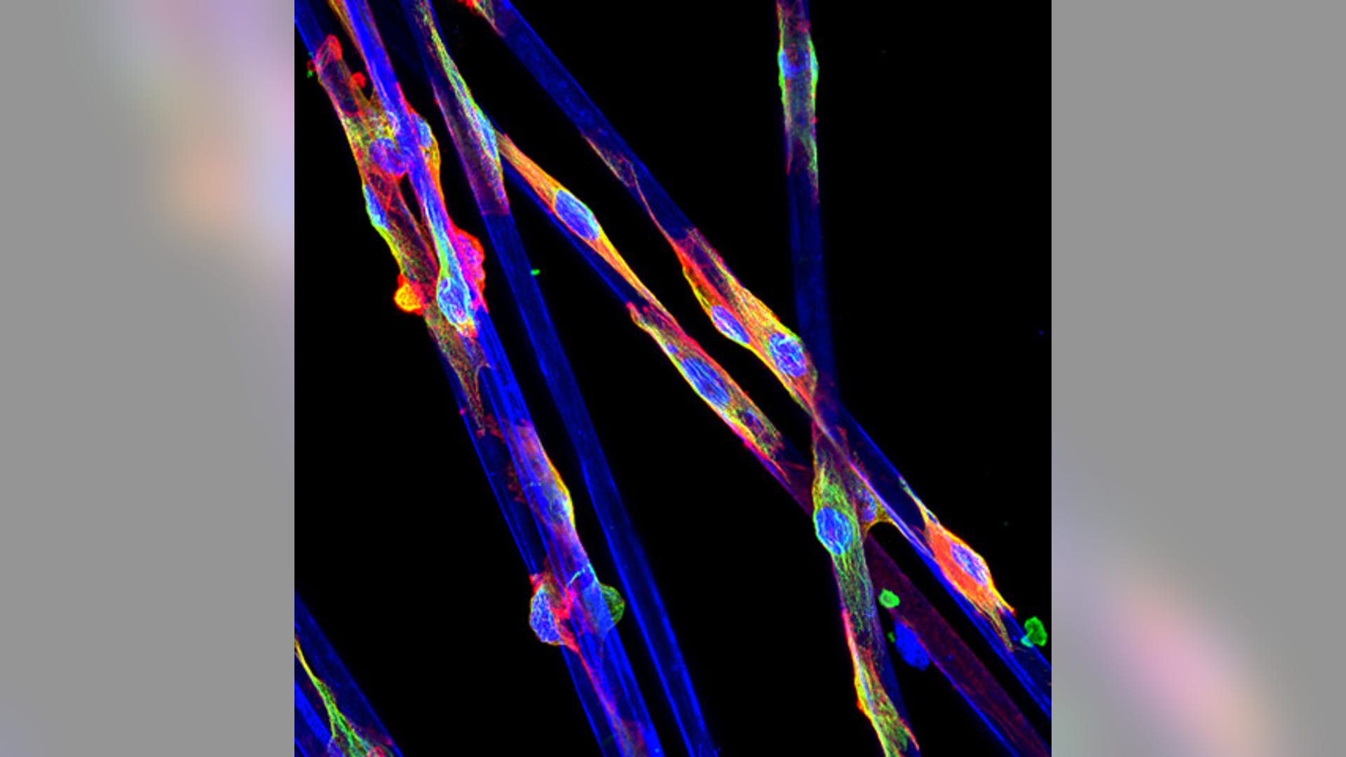 Inside Blood Vessels