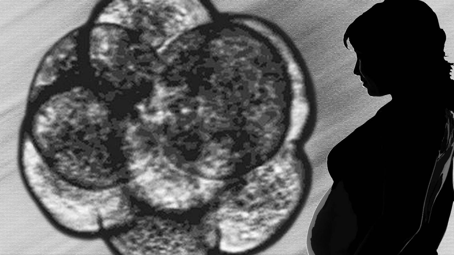 Docs Discover Dallas Twins Have Different Dads