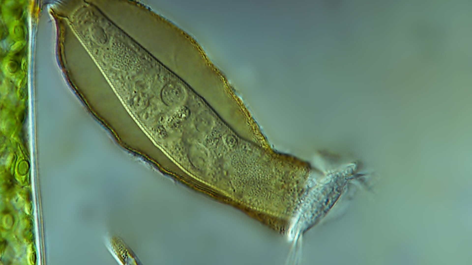 protozoan_pyxicola