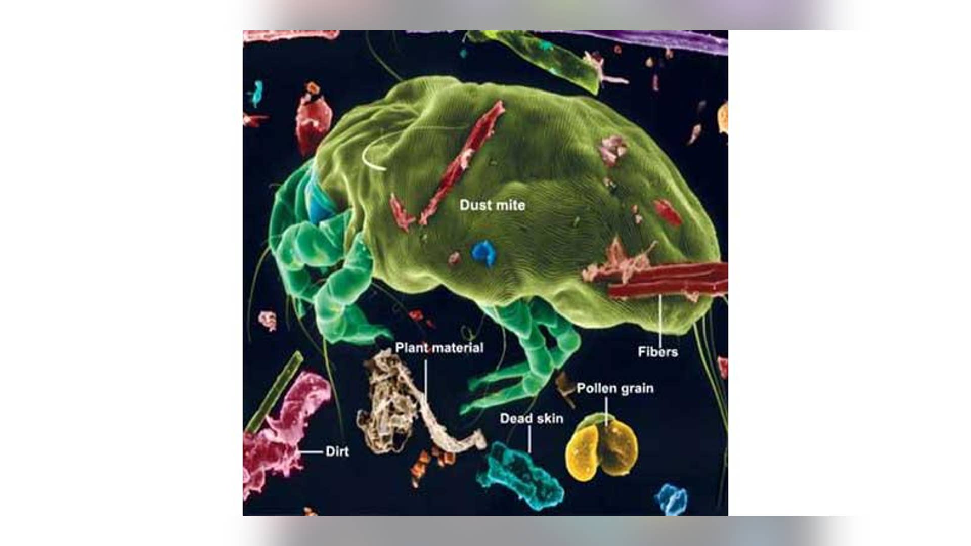 Find Out What You're Allergic to First
