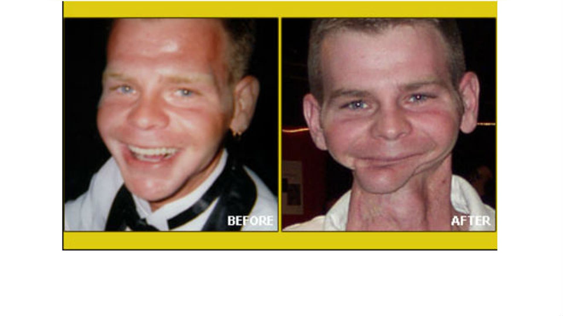 The faces of smokeless tobacco use
