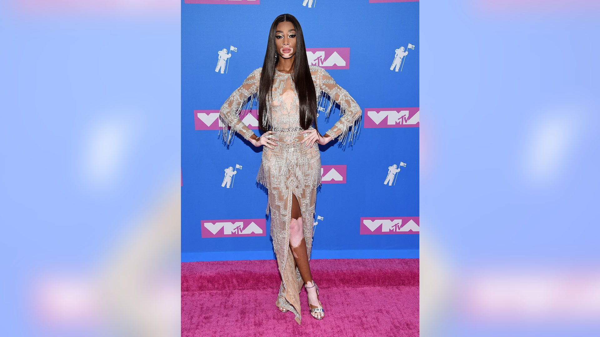 Winnie Harlow