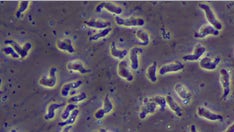 Rare brain-eating amoeba infection confirmed in Florida, health officials say